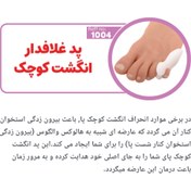 تصویر پد انحراف انگشت کوچک 