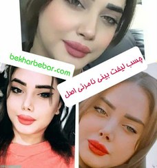 تصویر چسب لیفت بینی Nose lift glue