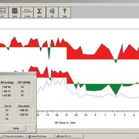 تصویر برنامه هولتر فشار آجیلیس ورژن 2.4 Agilis Holter Software CD v2.4