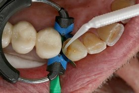 تصویر ماتریکس 3DXR سری M 