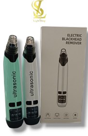 تصویر میکرودرم اسکوم دار دیجیتالی اولتراسونیک 