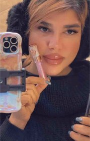 تصویر شاین لب لیپ گلاس خوش عطر و سبک 