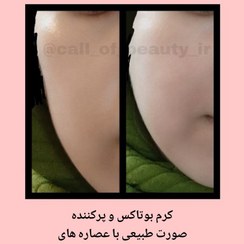تصویر کرم ضد چروک و جوانساز بوتاکس و پرکننده صورت طبیعی و گیاهی 