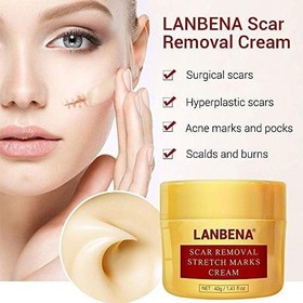 تصویر کرم کاسه ای رفع اسکار و استرچ لانبنا 40 میل lanbena scar removal stretch marks cream