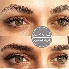 تصویر ژل لیفت ابرو جان اشلی 