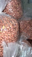 تصویر مغز لوکس 25 کیلویی 