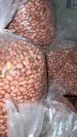 تصویر مغز لوکس 25 کیلویی 