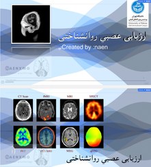 تصویر روانشناختی عصبی(نوروساینس) 
