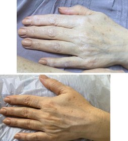 تصویر کرم جوانساز دست یارا 