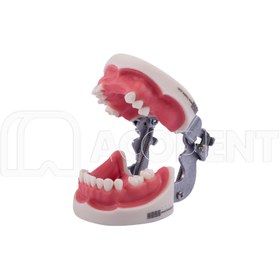 تصویر مدل فک ایمپلنت و سینوس لیفت 