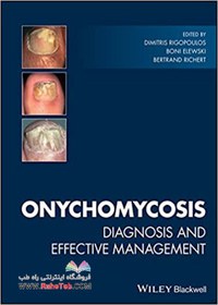 خرید و قیمت Onychomycosis: Diagnosis And Effective Management 1st ...