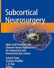 تصویر دانلود کتاب 2022 Subcortical Neurosurgery 