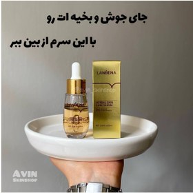 تصویر سرم ترمیم کننده و رفع اسکار لانبنا ۲۰ میلی lanbena