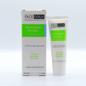 تصویر فیس دوس کرم آکنه هیدرا 