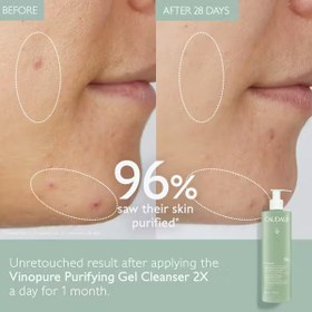 تصویر ژل شستشوی وینوپیور پوست مختلط تا مستعد آکنه کدلی 385 میل CAUDALI VINOPURE PURIFYING GEL CLEANSER FOR COMBINATION TO ACNE-PRONE SKIN 385 ML