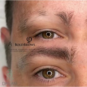 تصویر فیبروز آقایان 