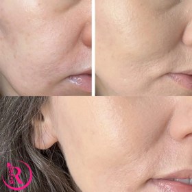 تصویر کوشن TIRTIR مدل Mask Fit Red Cushion رنگ 21N Elfenbein 