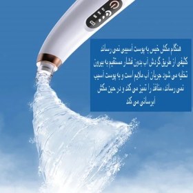 تصویر دستگاه میکرودرم لایه بردار و پاکسازی پوست 