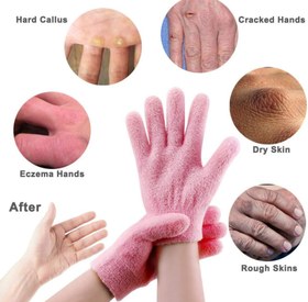 تصویر دستکش سیلیکونی درمانی 