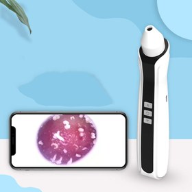 تصویر دستگاه ميكرودرم 