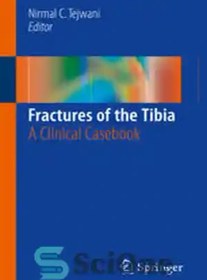 تصویر دانلود کتاب Fractures of the Tibia: A Clinical Casebook - شکستگی استخوان تیبیا: کتاب مورد بالینی 