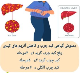 تصویر داروی کبد چرب گرید 1، گرید 2 و گرید 3، بدون عوارض 