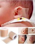 تصویر چسب فرم دهی گوش نوزاد ALIKE 