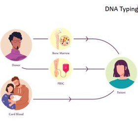 تصویر آزمایش HLA typing (تست سازگاری بافتی) 