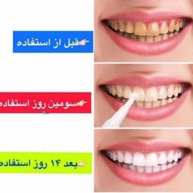 تصویر قلم سفید کنده دندان آمریکای برند دزلینگ وایت Dazling White 