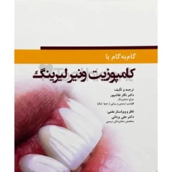 تصویر گام به گام با کامپوزیت لمینیت ونیر لیرینگ 