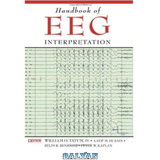 خرید و قیمت دانلود کتاب Handbook of EEG Interpretation | ترب