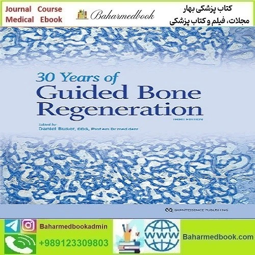 خرید و قیمت 30Years of Guided Bone Regeneration in Implant Dentistry ...