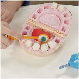 تصویر ست اسباب بازی دندان پزشکی PLAY-DOH 