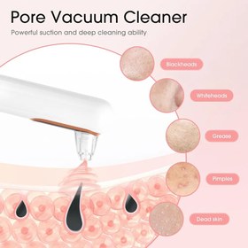 تصویر دستگاه پاک سازی صورت میکرودرم ،پاک کننده جوش سر سیاه، پاک کننده منافذ، با 4 سر مکش، مکش جوش سر سیاه، رفع جوش، جاروبرقی، 4 حالت، پاک کننده منافذ صورت، شارژ USB، رفع جوش، مدل Y002 Blackhead Remover, Pore Cleaner, Pore Vacuum Cleaner with 4 Suction Heads, Blackhead Suction, Pimple Remover, Vacuum Cleaner, 4 Modes, Face Pore Cleaner, USB Charging, Acne Remover, Device