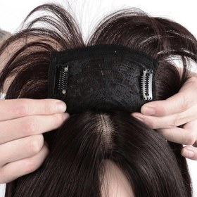 تصویر پروتز چتری پرحجم 