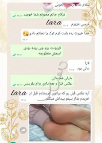 تصویر کرم ترک پای یارا 