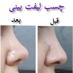 تصویر چسب لیفت بینی 9متری 