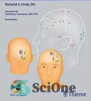 خرید و قیمت دانلود کتاب Yamamoto new scalp acupuncture: principles and ...
