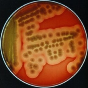 تصویر باسیلوس سرئوس Bacillus cereus Bacillus cereus