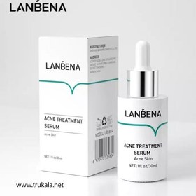 تصویر سرم ضد جوش حجم 15 میل لنبنا Lanbena Acne Treatment Serum 15 ml