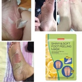 تصویر ماسک پا لایه بردار پیوردرم Purederm Shiny & Soft Foot Peeling Mask set