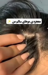 تصویر روغن آرگان انزو ۱ لیتری 