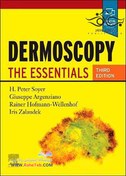 تصویر دانلود کتاب Dermoscopy: The Essentials [3&nbsp;ed.] کتاب انگلیسی درموسکوپی