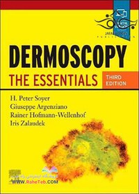 تصویر دانلود کتاب Dermoscopy: The Essentials [3&nbsp;ed.] کتاب انگلیسی درموسکوپی