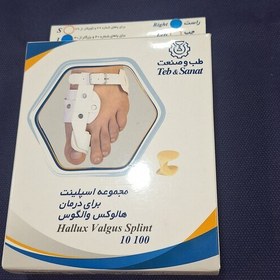 تصویر مجموعه اسپلینت برای درمان هالوکس والگوس 