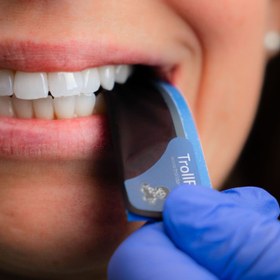 تصویر کاغذ آرتیکولاسیون 