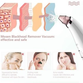 تصویر میکرودرم خانگی MOSEN M1905 