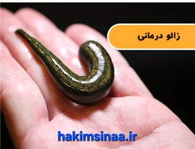 تصویر زالو پرورشی 