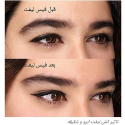 تصویر کش لیفت ابرو وشقیقه 