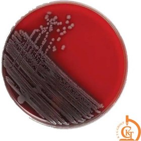 تصویر محیط کشت blood agar 